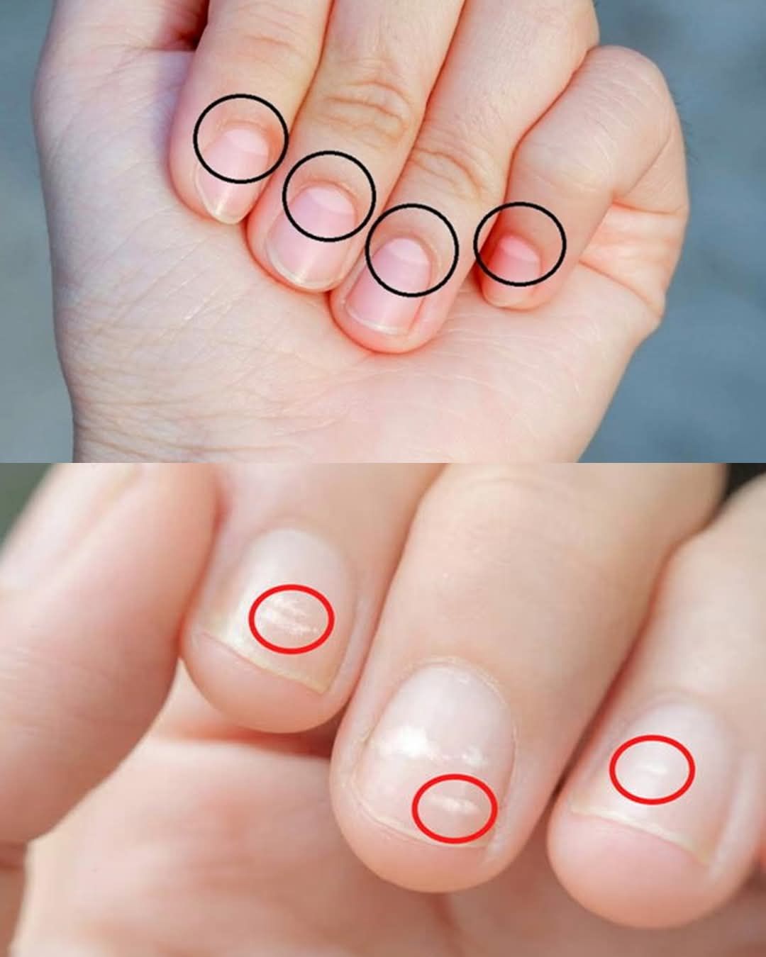 The Crescent Moon on the Nails Reveals Our State of Health