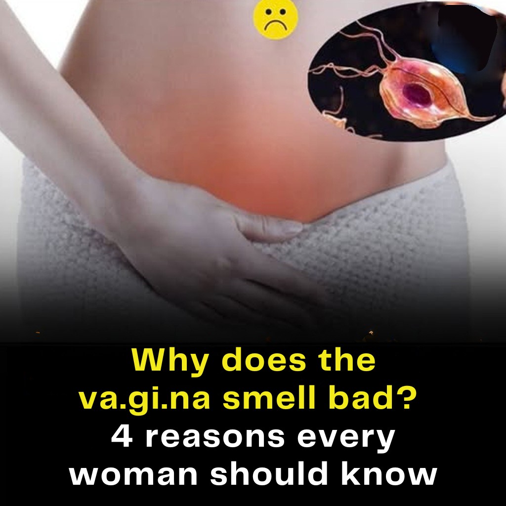 Why does the va.gi.na smell bad? 4 reasons every woman should know