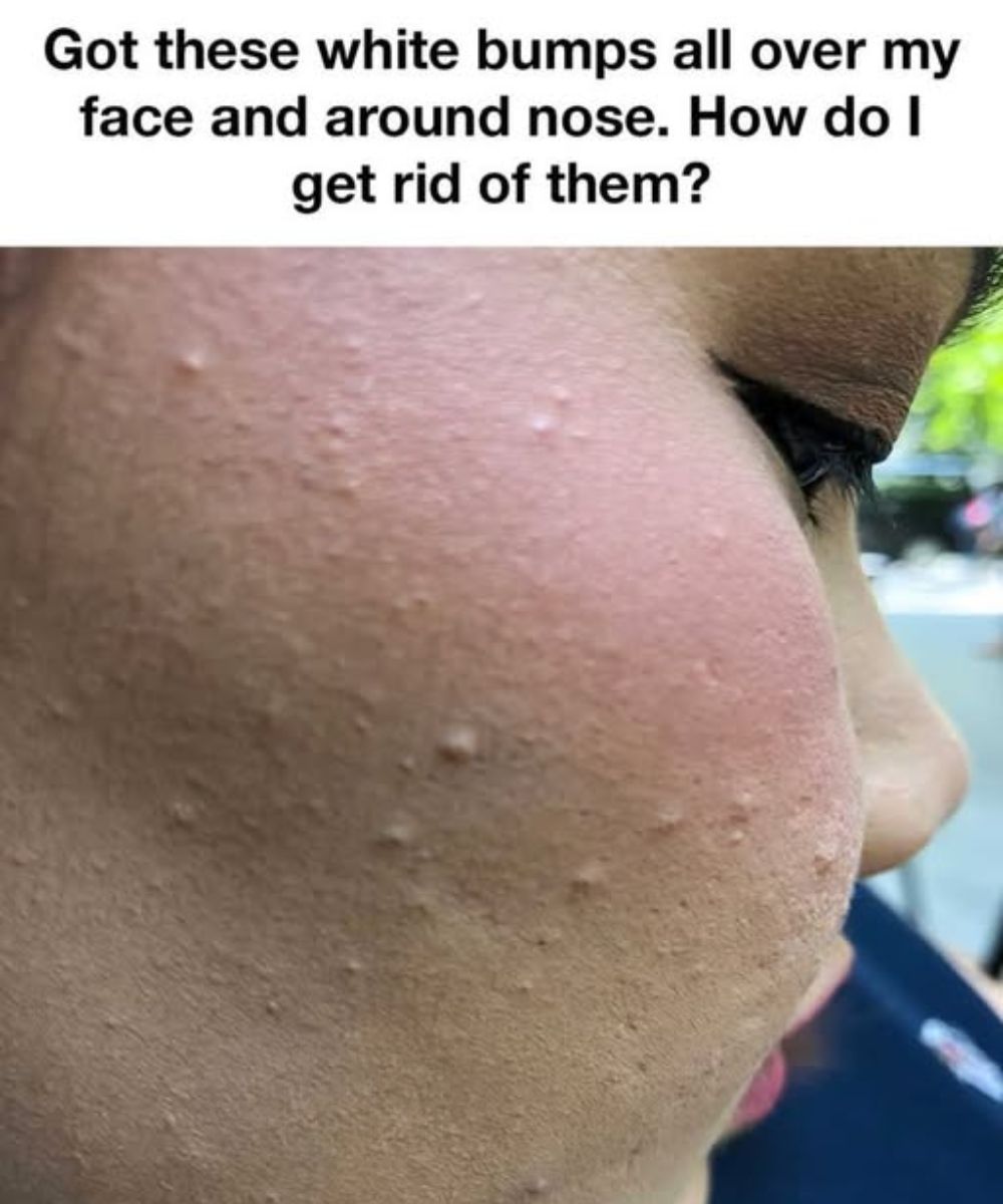 I truly am bothered by these!