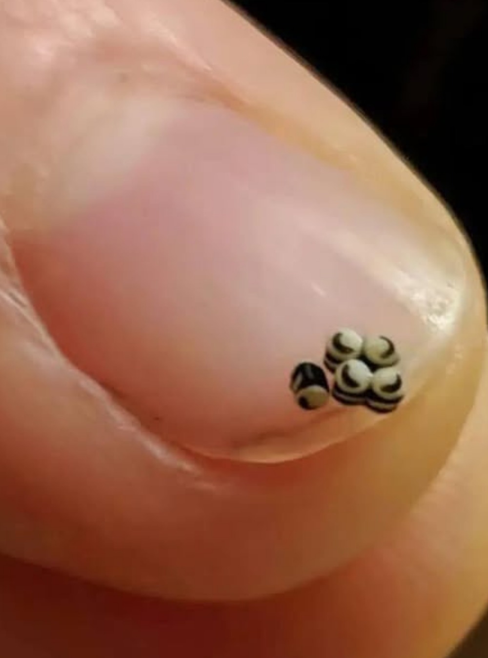 We Ordered a Salad and Noticed Small Dark Particles in the Food, So We Sought Medical Care Immediately