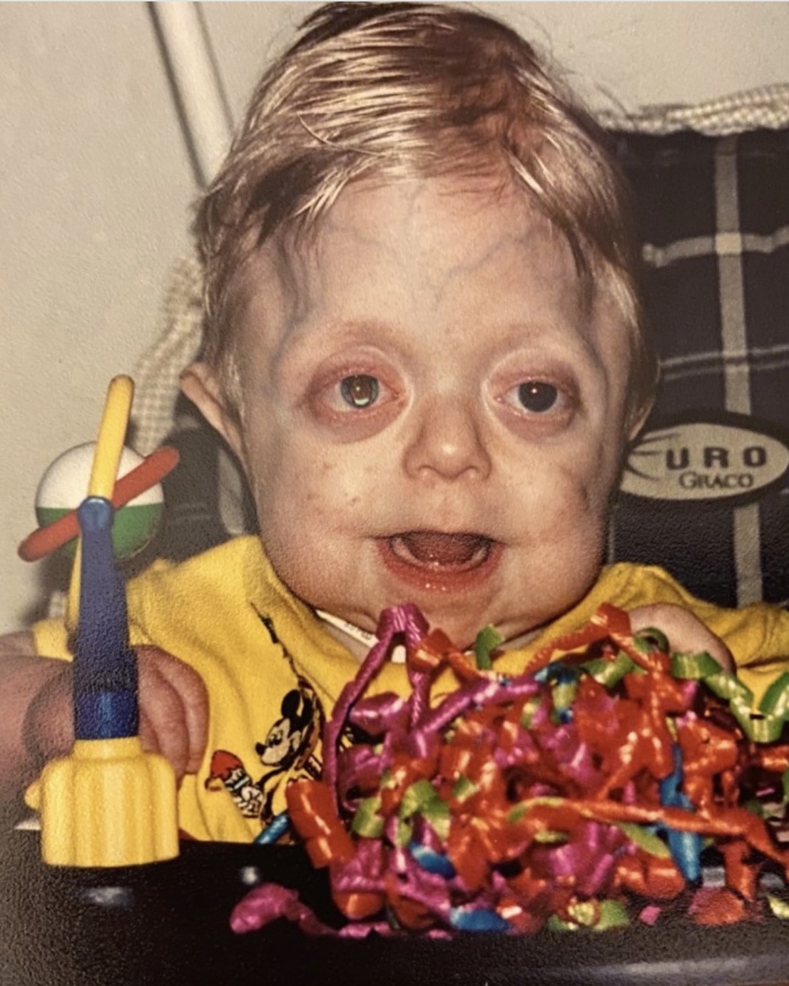 Teen who wasn’t expected to live 18 months graduates high school