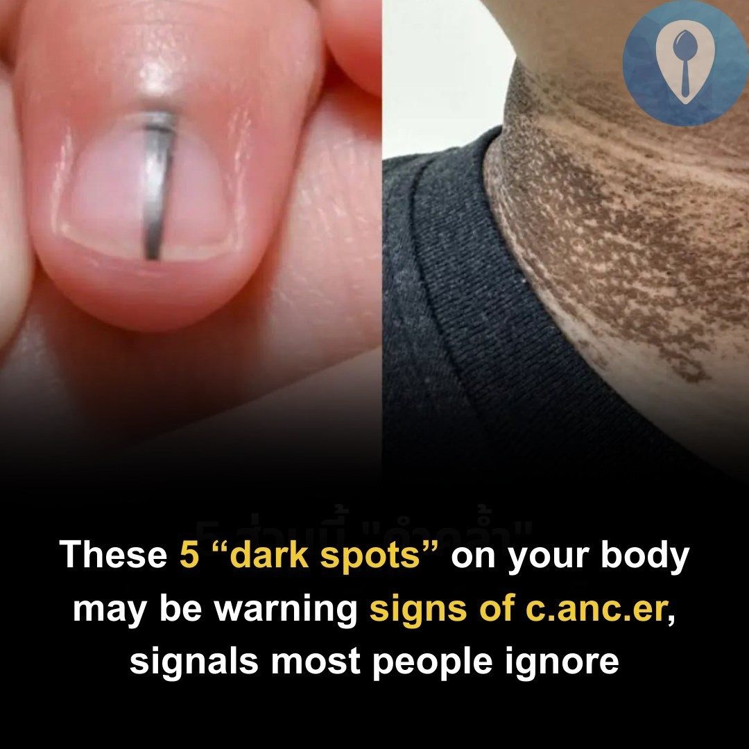 5 warning signs that can.cer may be developing but are often overlooked